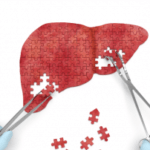 Вберегтися від гепатиту В можна завдяки вакцинації. Вакцини проти гепатиту С не існує