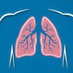 ЯК НЕ СПЛУТАТИ COVID-19 З ТУБЕРКУЛЬОЗОМ