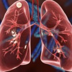 За рівнем захворюваності Чернігівська область займає 16 місце серед інших областей України